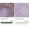 S100 Calcium Binding Protein A4 antibody, NBP2-52892, Novus Biologicals, Immunohistochemistry paraffin image 
