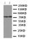 ATP Binding Cassette Subfamily G Member 4 antibody, LS-C313194, Lifespan Biosciences, Western Blot image 