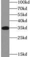 Cyclin Dependent Kinase 2 antibody, FNab01554, FineTest, Western Blot image 