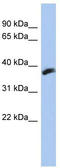 Cytochrome B5 Reductase Like antibody, TA336043, Origene, Western Blot image 
