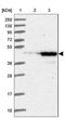 UEV And Lactate/Malate Dehyrogenase Domains antibody, NBP1-92561, Novus Biologicals, Western Blot image 