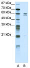 FEZ Family Zinc Finger 2 antibody, TA345233, Origene, Western Blot image 