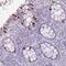 Biogenesis Of Lysosomal Organelles Complex 1 Subunit 2 antibody, HPA048088, Atlas Antibodies, Immunohistochemistry paraffin image 