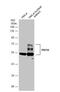 PHD Finger Protein 10 antibody, NBP2-19795, Novus Biologicals, Western Blot image 
