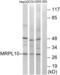 Mitochondrial Ribosomal Protein L10 antibody, abx014077, Abbexa, Western Blot image 