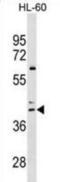 C-C Motif Chemokine Receptor 4 antibody, abx030049, Abbexa, Western Blot image 