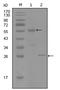 Progesterone Receptor antibody, AM06274SU-N, Origene, Western Blot image 