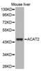 ACAT2 antibody, abx001923, Abbexa, Western Blot image 