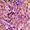 Mitochondrial Ribosomal Protein L17 antibody, GTX56039, GeneTex, Immunohistochemistry paraffin image 
