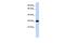 Sushi Domain Containing 3 antibody, GTX45277, GeneTex, Western Blot image 