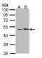 Epoxide Hydrolase 1 antibody, NBP1-33011, Novus Biologicals, Western Blot image 