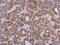 Zinc Finger SWIM-Type Containing 2 antibody, GTX118963, GeneTex, Immunohistochemistry paraffin image 