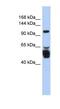 Leucine Rich Repeat Containing 8 VRAC Subunit B antibody, NBP1-59968, Novus Biologicals, Western Blot image 