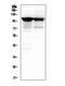 Actinin Alpha 3 (Gene/Pseudogene) antibody, M02693, Boster Biological Technology, Western Blot image 