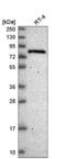 RBM35B antibody, NBP2-58259, Novus Biologicals, Western Blot image 