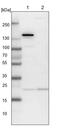 ADP Ribosylation Factor Like GTPase 3 antibody, PA5-57599, Invitrogen Antibodies, Western Blot image 