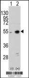 Neuronal pentraxin-2 antibody, LS-C98577, Lifespan Biosciences, Western Blot image 