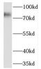 Prolyl endopeptidase antibody, FNab06767, FineTest, Western Blot image 