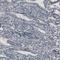 Cancer/Testis Antigen 83 antibody, NBP1-84343, Novus Biologicals, Immunohistochemistry frozen image 