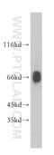 Bardet-Biedl Syndrome 9 antibody, 14460-1-AP, Proteintech Group, Western Blot image 