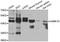 Calcium/Calmodulin Dependent Protein Kinase ID antibody, A05050, Boster Biological Technology, Western Blot image 