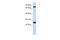 Zinc Finger Protein 799 antibody, A16974, Boster Biological Technology, Western Blot image 