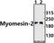 Myomesin 2 antibody, A12094Y644, Boster Biological Technology, Western Blot image 