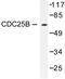 Cell Division Cycle 25B antibody, LS-C175949, Lifespan Biosciences, Western Blot image 