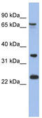 TBC1 Domain Family Member 25 antibody, TA337671, Origene, Western Blot image 