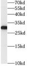 Glutathione S-transferase omega-1 antibody, FNab03697, FineTest, Western Blot image 