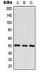 Eukaryotic Translation Elongation Factor 1 Gamma antibody, LS-C353969, Lifespan Biosciences, Western Blot image 