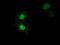 Sulfotransferase Family 1A Member 1 antibody, MA5-25272, Invitrogen Antibodies, Immunocytochemistry image 