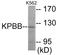 Phosphorylase Kinase Regulatory Subunit Beta antibody, EKC1895, Boster Biological Technology, Western Blot image 
