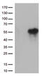 Hepatitis A Virus Cellular Receptor 2 antibody, TA812562S, Origene, Western Blot image 