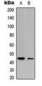 CLN5 Intracellular Trafficking Protein antibody, orb304726, Biorbyt, Western Blot image 