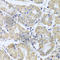 Centrosomal Protein 57 Like 1 antibody, A8290, ABclonal Technology, Immunohistochemistry paraffin image 