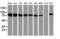 Protein Kinase C Epsilon antibody, M01151-1, Boster Biological Technology, Western Blot image 