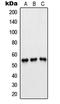 6-phosphofructo-2-kinase/fructose-2,6-biphosphatase 1 antibody, LS-C352637, Lifespan Biosciences, Western Blot image 