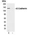 Cadherin 1 antibody, orb213706, Biorbyt, Immunoprecipitation image 