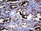 Polypeptide N-Acetylgalactosaminyltransferase 10 antibody, M09635, Boster Biological Technology, Immunohistochemistry paraffin image 