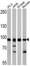 Forkhead Box O3 antibody, PA1-805, Invitrogen Antibodies, Western Blot image 