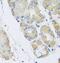 Ribosomal Protein Lateral Stalk Subunit P1 antibody, FNab07449, FineTest, Immunohistochemistry paraffin image 