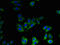 Solute Carrier Family 41 Member 2 antibody, LS-C285610, Lifespan Biosciences, Immunofluorescence image 