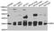 Carbonyl Reductase 3 antibody, STJ29683, St John