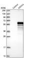 Uncharacterized aarF domain-containing protein kinase 4 antibody, NBP1-85510, Novus Biologicals, Western Blot image 