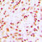 CREB Binding Protein antibody, LS-C355975, Lifespan Biosciences, Immunohistochemistry paraffin image 