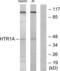 5-Hydroxytryptamine Receptor 1A antibody, LS-C119365, Lifespan Biosciences, Western Blot image 