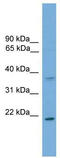Glutathione S-transferase Mu 1 antibody, TA346206, Origene, Western Blot image 