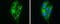 4-Aminobutyrate Aminotransferase antibody, GTX100479, GeneTex, Immunofluorescence image 