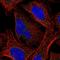 Casein Kinase 1 Gamma 2 antibody, NBP2-49232, Novus Biologicals, Immunocytochemistry image 